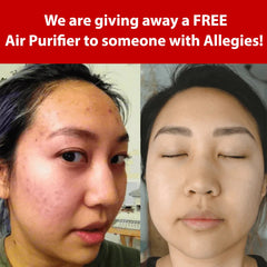 Giving away FREE Air Purifier to people with Allergies! - Sterra